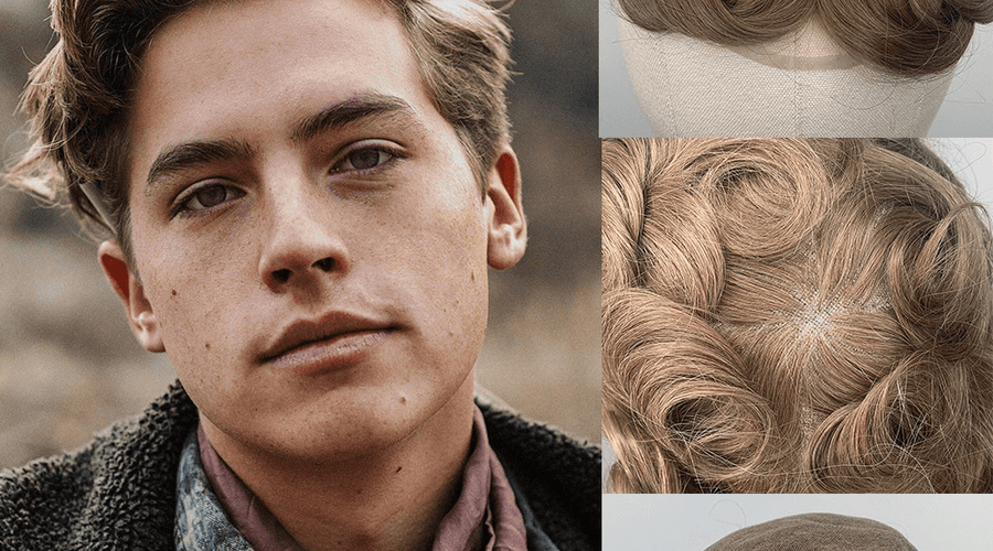 How To Live With An Hair Replacement System?  | 2020