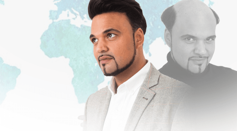 Different Types of Non-Surgical Hair Replacement for Men Techniques