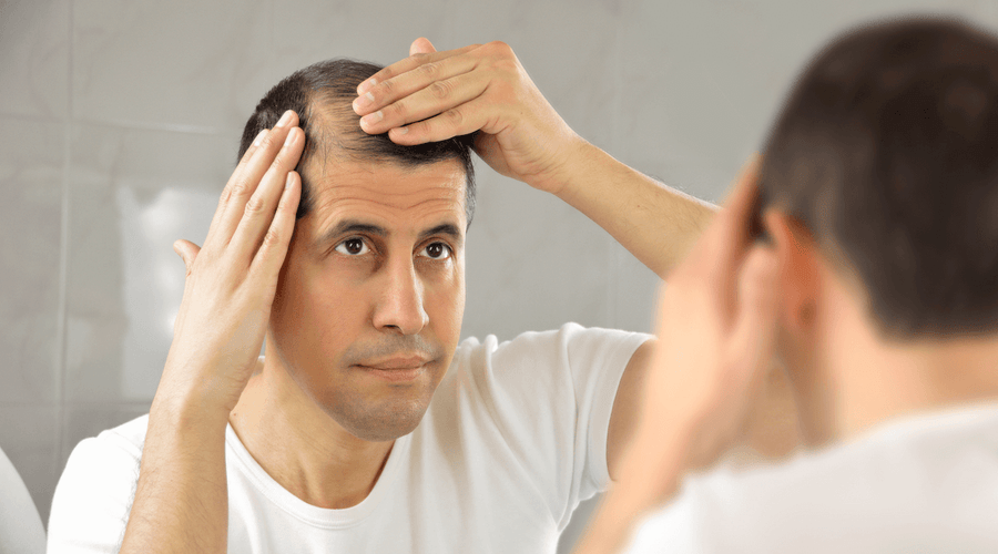 Hair Replacement System: A Comprehensive Guide 2020