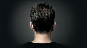 3 Myths about hd Hair Replacement and Hair loss due to Anxiety