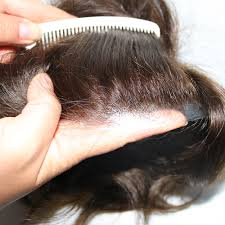How to wash tl700 hair system without damaging scalp?