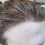 0.03mm Invisible Super Thin Skin Hair System