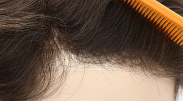 Toupee Company Debunks the 8 Myths about Non-surgical Hair Transplant