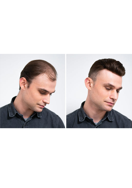 Mono with Thin Skin Perimeter Off Black Hairpieces for Men
